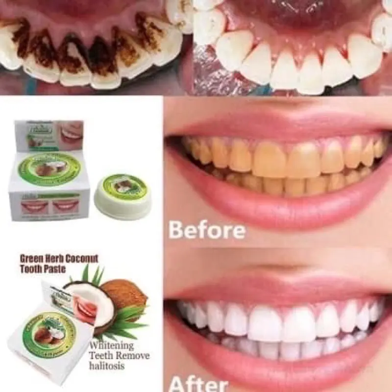 Kem Tẩy Trắng Răng Loại Bỏ Ố Vàng Làm Trắng Răng Green Herbal Novolife Thái Lan Đánh Răng