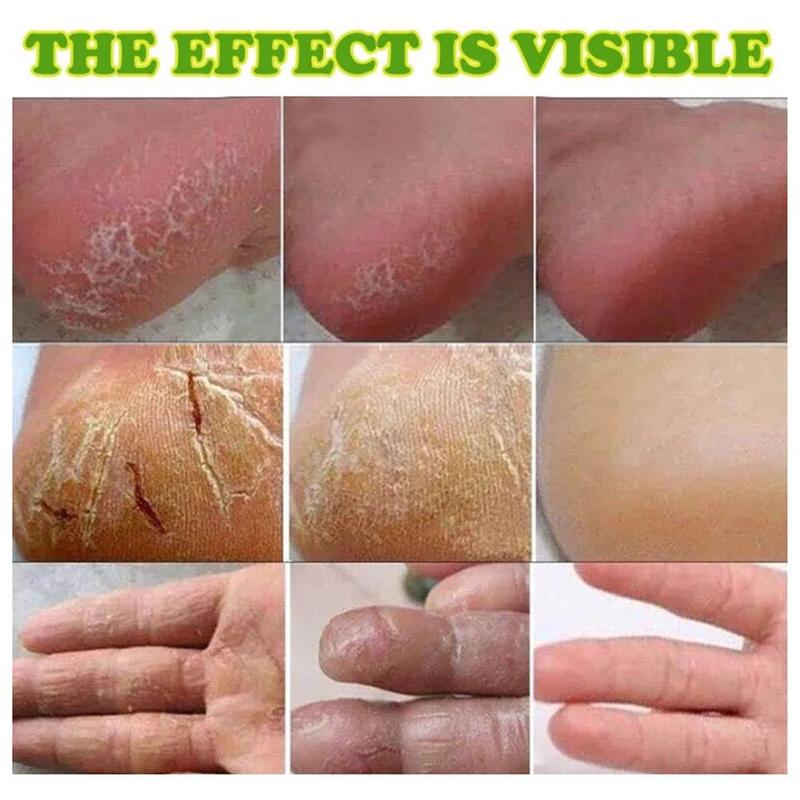 Product Introduction of Horse Oil Anti-Drying Crack Foot Cream Heel Cracked Removal Dead Cream Hand Feet Skin Repair X3L9 31