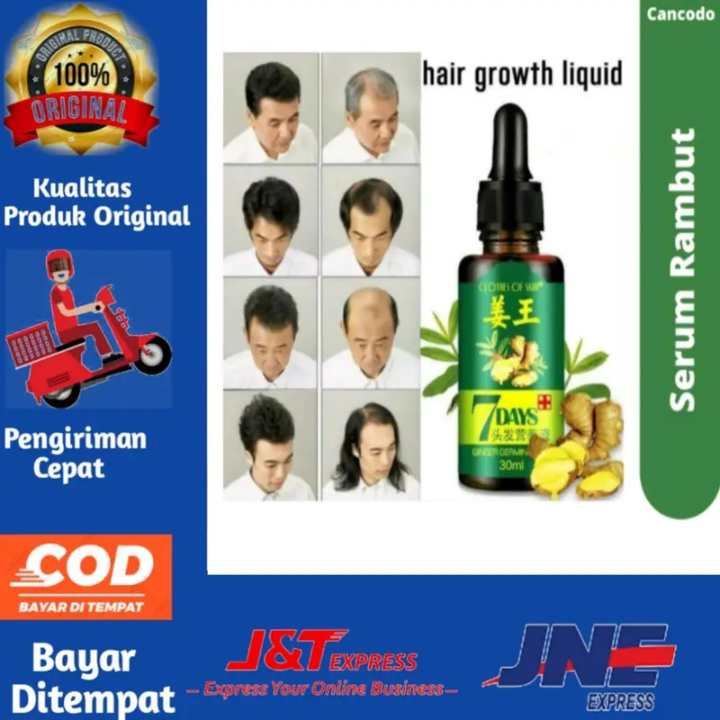 ️️BIG SALE️ ️ORI [PENUMBUH RAMBUT BOTAK] Essence Anti Rontok / Botak Asli Obat Uban Penghitam Penyubur Original 1