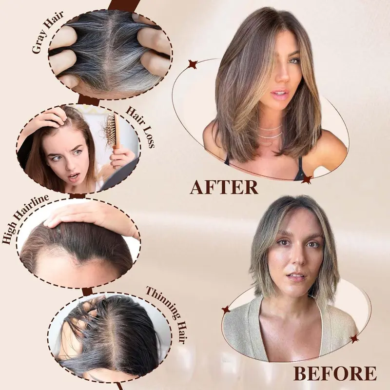 Local shipping- 14 Inch Light Blonde & Brown Hair Toppers for Women Human Hair Toppers Hair Pieces Swiss Base with 3 Clips in Wiglets Toppers for Women with Thinning Hair Grey Hair Loss 3