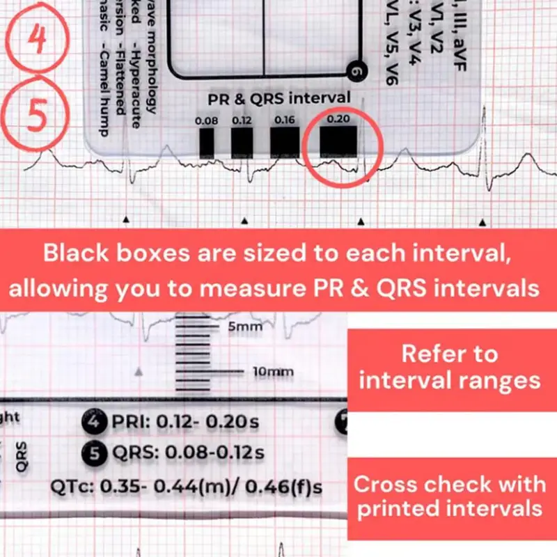 Thước 7 Bước, Cầm Tay, Hướng Dẫn Tham Khảo Bỏ Túi Giải Thích Ecg, Trong Suốt, Thiết Kế Nhỏ Gọn, Dụng Cụ Đánh Giá, Để Đo Lường 5