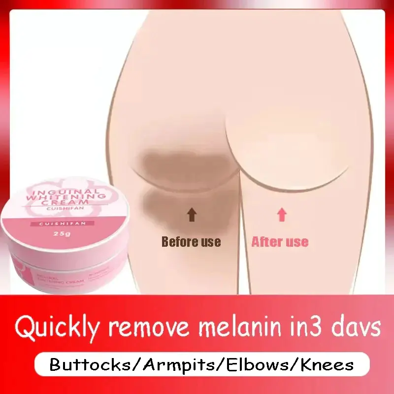 [Hot-selling]armpit private part whitening cream thigh buttock elbow whitening take take inguinguinal whitening cream whitening body remove melanin brighten skin tone take effect quickly 25g