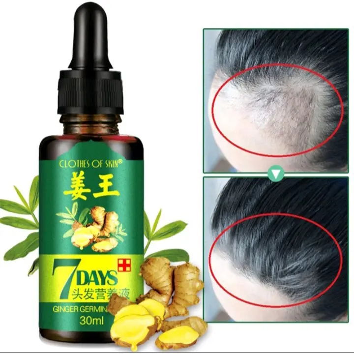 ️️BIG SALE️ ️ORI [PENUMBUH RAMBUT BOTAK] Essence Anti Rontok / Botak Asli Obat Uban Penghitam Penyubur Original 2