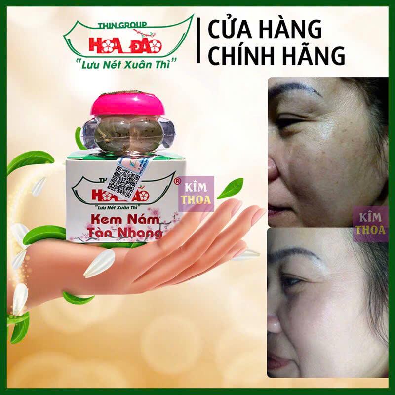 Kem Nám Tàn Nhang Hoa Đào - Giảm Nám Tàn Nhang Sáng Da Tự Nhiên - An Toàn & Hiệu Quả