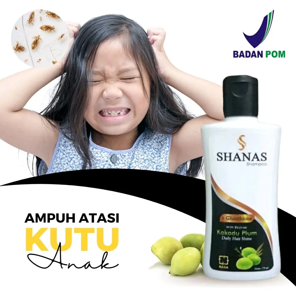 Shampoo + Conditioner Membersihkan  kutu DAN   rambut anak sampo shanas nasa Haircare Perawatan antiketombe shampo penghilang ketombe