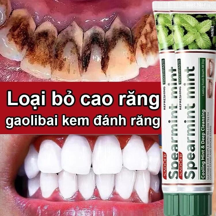 Kem đánh răng làm trắng răng loại bỏ cao răng hôi miệng tẩy ố vàng 100g làm trắng làm sạch răng làm mới hơi thở khử mùi chống sâu răng ức chế vi khuẩn phục hồi nướu hư tổn