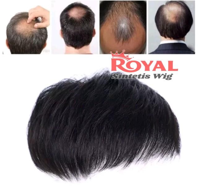Product Introduction of WIG PRIA PENDEK / TOUPEE TUTUP BOTAK / WIG RAMBUT PENUTUP KEBOTAKAN 2