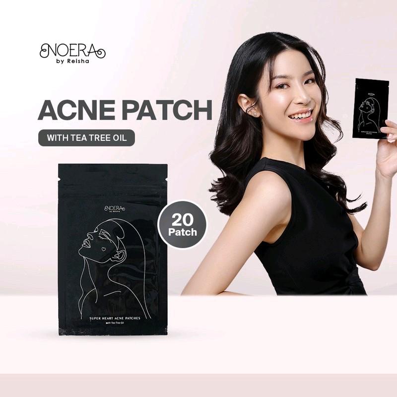 Noera Acne Patch - Membantu menyembuhkan jerawat 4