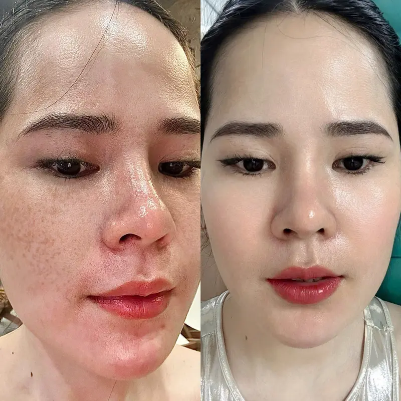 COMBO KEM FACE NGÀY và ĐÊM Sâm nám 8G ban đêm.Bạch nhân sâm 8G ban ngày TẶNG KÈM SERUM 5