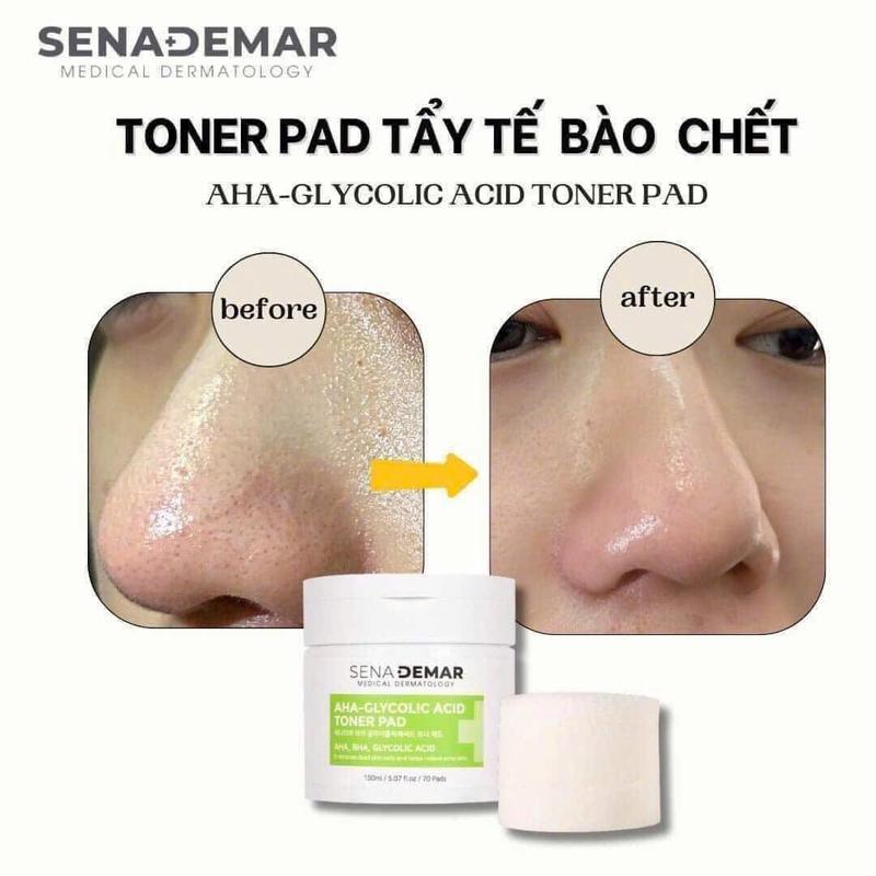 Senademar - Toner pad AHA-GLYCOLIC ACID, Tẩy da chết, 70 miếng [Tặng 1 Nạ] Skincare 2