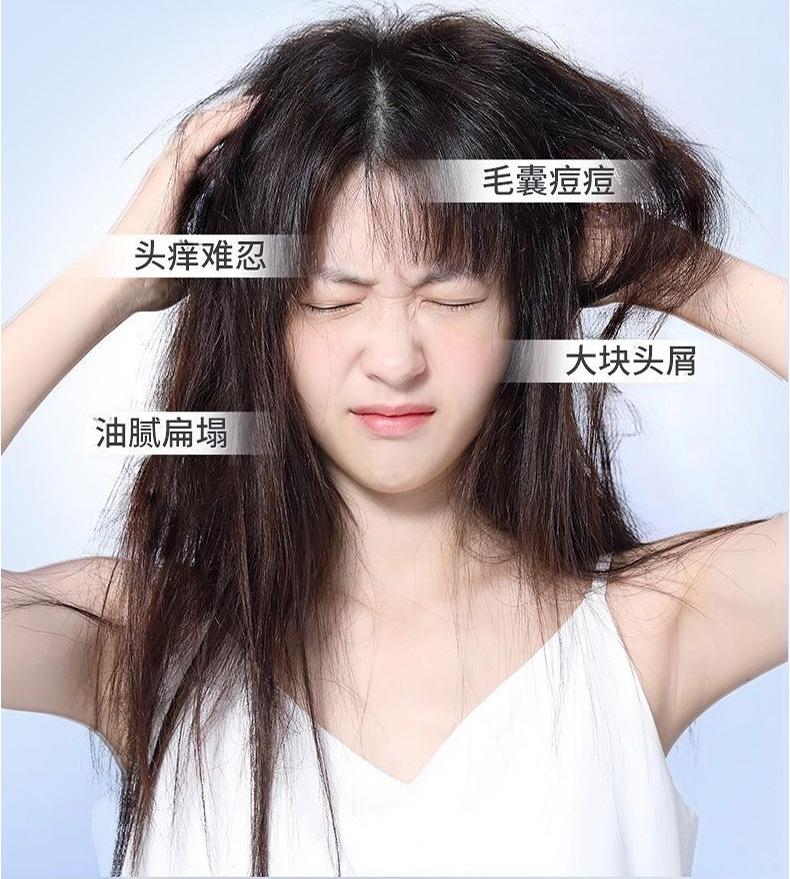 Product Introduction of Xikangwang Anti-Dandruf and Relieve Itching Washing Water Oil Removing Refreshing Skin Washing Cream Anti-Mite Grease-Overflow Moss Lotion 7