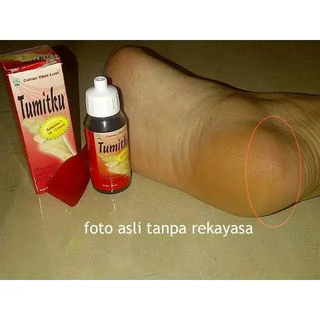 HEMAT 2 pcs Tumitku Perawatan Kapalan Gratis Ongkir 4
