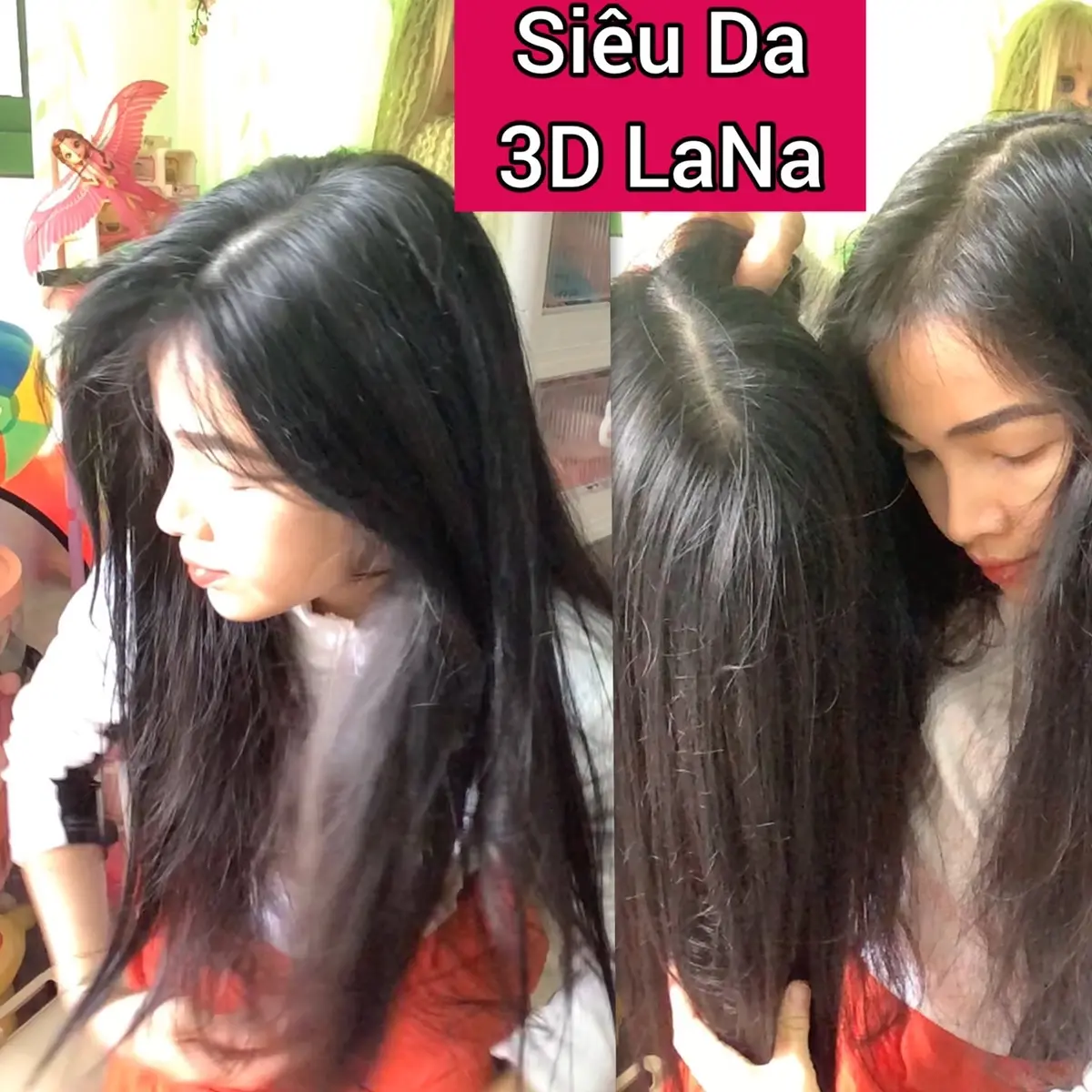 Tóc mái phủ hói thưa siêu Da 3D(tơ cao cấp) Nữ