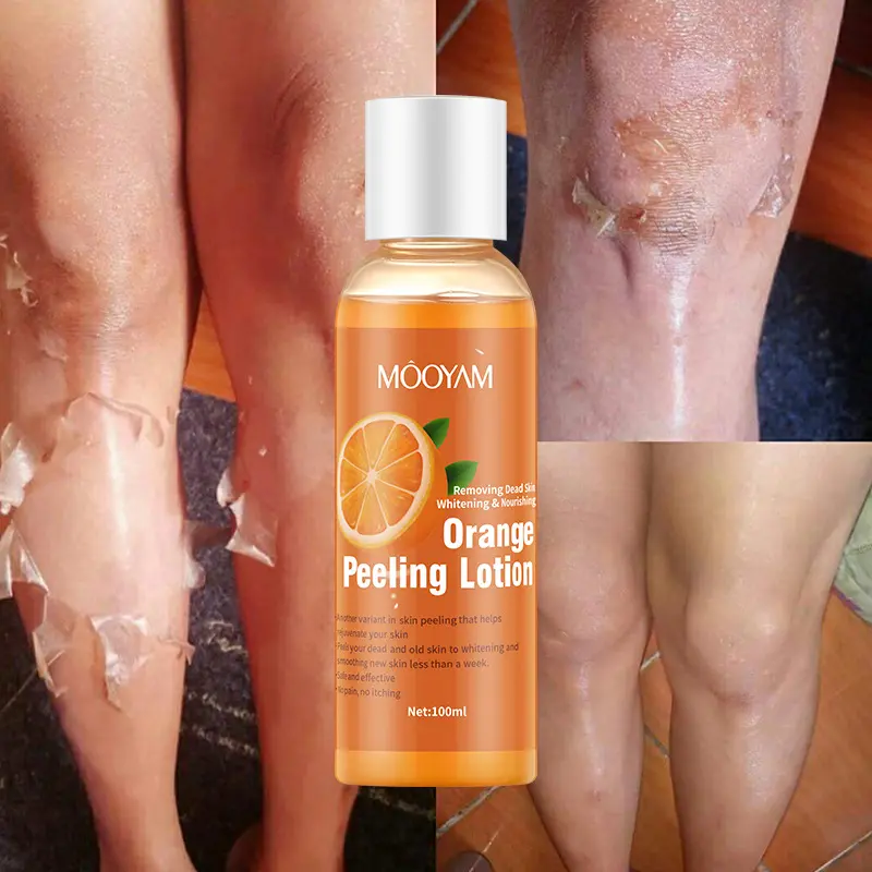 Orange Peel Lotion Peeling Oil Body Lotion Mild Exfoliating Gel Lotion Orange Peeling Lotion
