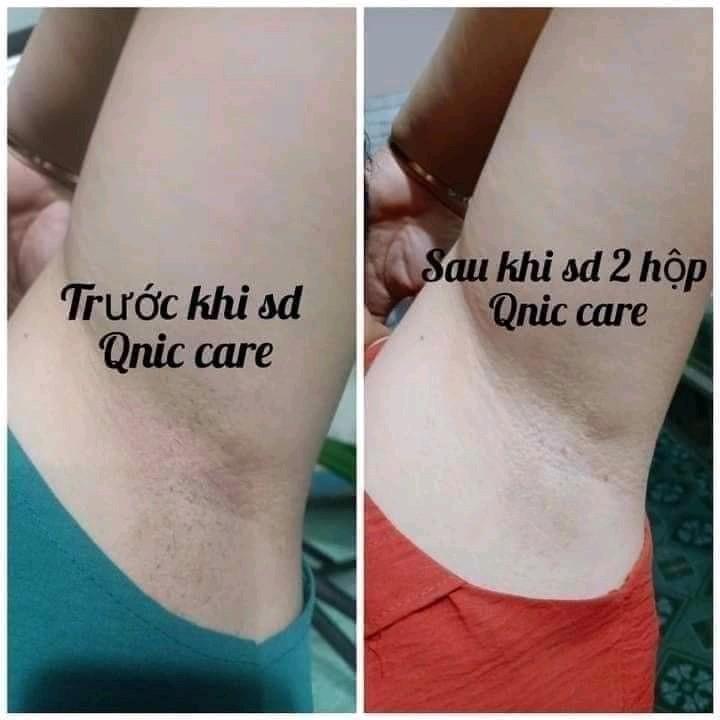 KEM T.RỊ THÂM NÁCH Q-NIC THÁI LAN 4