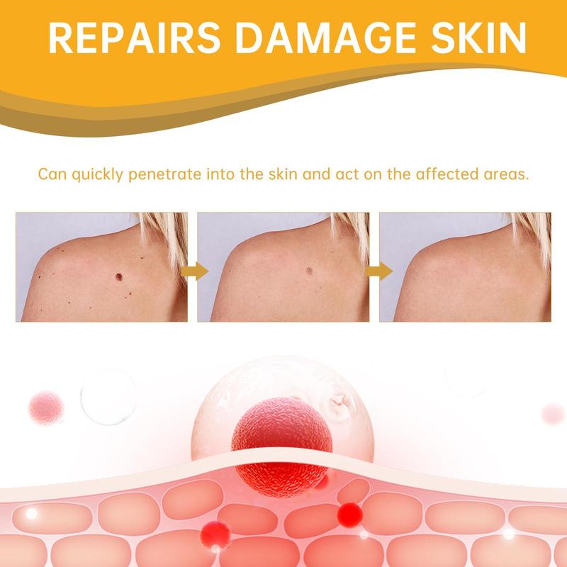 Product Introduction of Bee Venom Wart Cleansing Spray, 1 Piece Wart Care Spray, Skin Care Product for Improving Skin Granular Nevi, Smoothing Skin Warts, Suitable for Men and Women 7