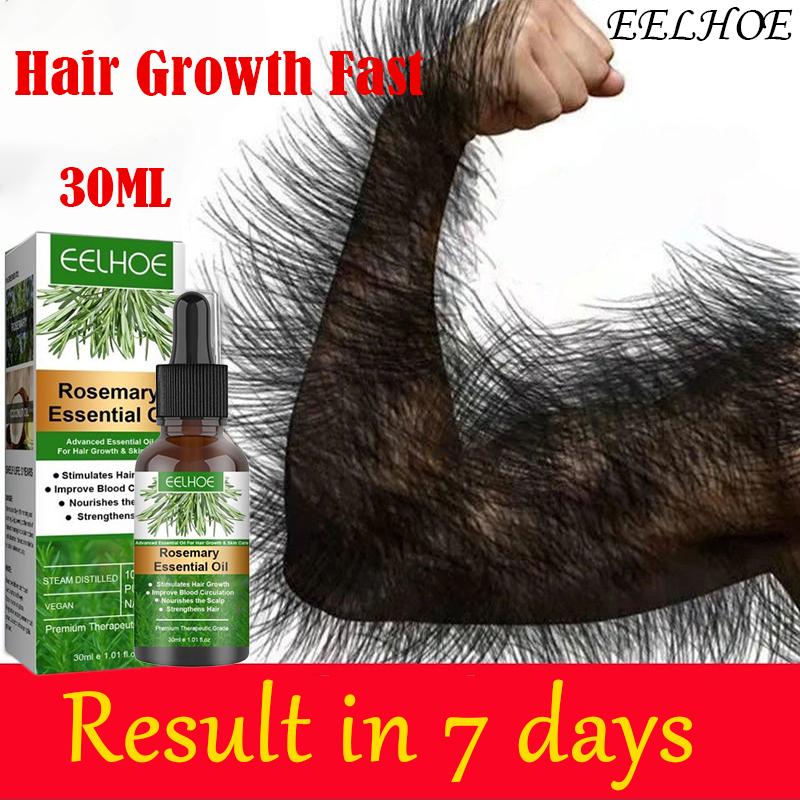Serum Mọc Tóc, 30ML, Dành Cho Nam Giới, Nguyên Bản Minoxidil, Điều Trị Rụng Tóc, Mọc Tóc Nhanh, Điều Trị Tóc Dài, Xịt Mọc Tóc, Thích Hợp Cho Phụ Nữ, Pampakapal ng Buhok, Pampatubo ng Buhok sa Buod