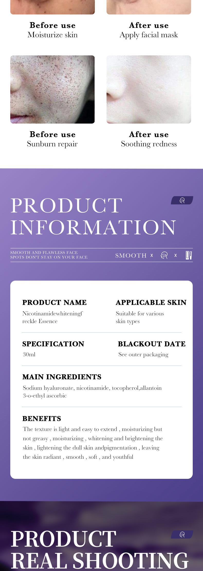 Product Introduction of Niacinamide serum whitening Dark Spot Remover Serum 30ml melasma serum remover melasma and Pekas Remover Serum original whitening and freckle removing oil small molecule time coagulation extract orchid semen tening anti-wrinkle  jhy005 8