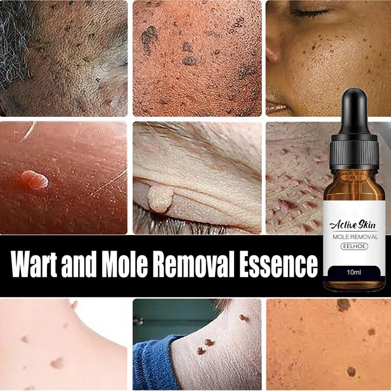Eelhoe Aclive Skin Mole Removal, Serum Penghilang Tahi Lalat Dan Kutil Isi 10ml Perawatan Essence Cairan 4