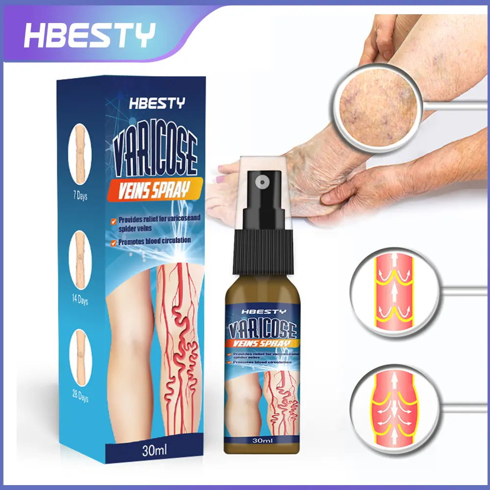 HBESTY Vein Relaxation Spray Leg Vascular Health Care Solution 30ml ...