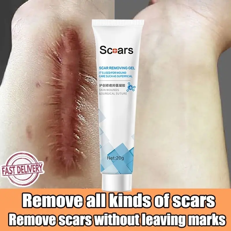 Scar Removal Cream 20gScar Repair Lighten Acne Pits Scars Stretch Marks Smooth Skin
