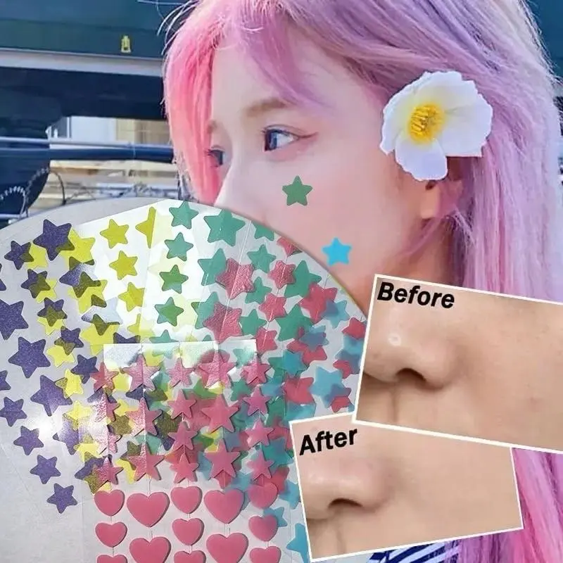 Acne patch lucu Pimple Patch Penghilang Jerawat Acnes Spot Care Plester Jerawat Acne Treatment 36 buah  stiker jerawat Cute Star/Heart Pimple Patch 0