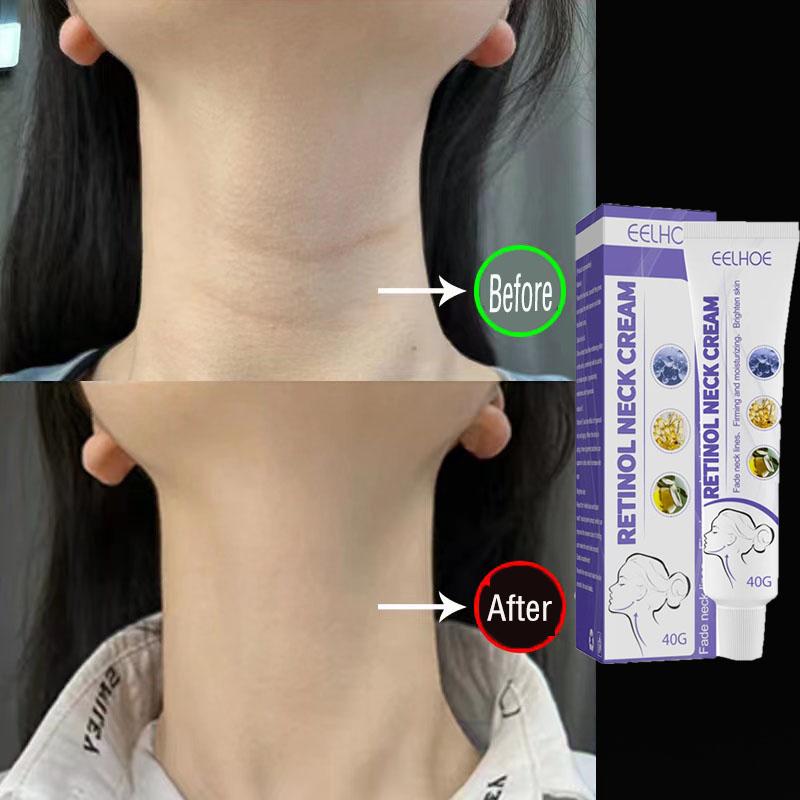 Kem trẻ hóa làm săn chắc vùng cổ giúp da chống nhăn làm trắng dưỡng ẩm cổ dung tích 40g - intl