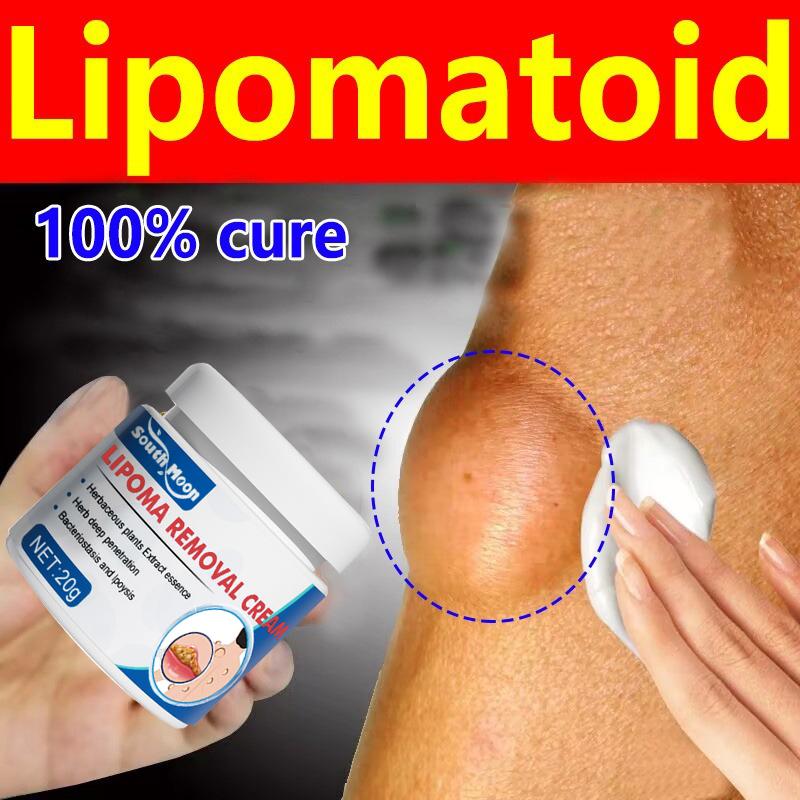 Krim Perbaikan Benjolan Lemak, Benjolan Keras, Benjolan Subkutan, Lipoma, Salep Benjolan, Krim Penghapus Lipoma, Secara Khusus Menghilangkan Beberapa Benjolan Subkutan Tunggal, Krim Benjolan Kulit / Obat Benjolan Efektif