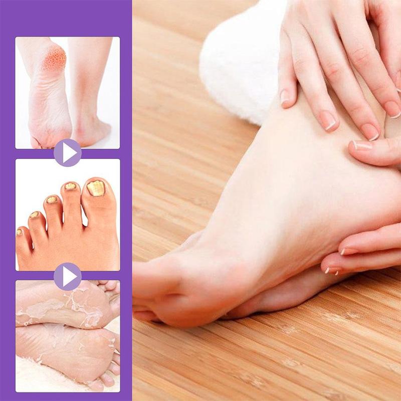 Foot Peel Mask Skin Exfoliating Foot Masks For Dry Rough Cracked Feet Heels Callus Dead Skin R0V9 6