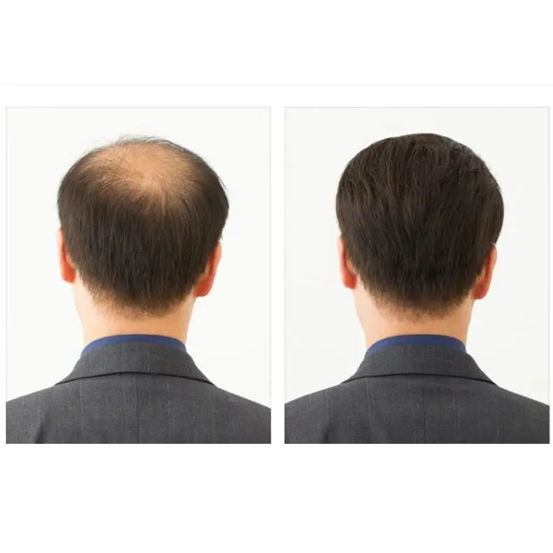 Tóc Giả Nam Trung Niên Tóc Giả Tóc Ngắn, Tóc Người, Kiểu Tóc Đẹp, Làm Bằng Tóc Thật, Tăng độ phồng tóc, Tóc Mái Bằng Không Khí, Che Phủ Tóc Màu Xám, Giao Hàng Địa Phương, Giao Hàng Nhanh, 3 Ngày Giao Hàng 7