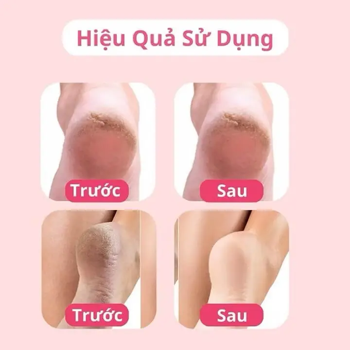 ￼Máy chà gót chân tẩy tế bào chết tự động, máy mài gót chân tích điện cho tiệm nail spa, chăm sóc da tại nhà, 2 đầu mài 6