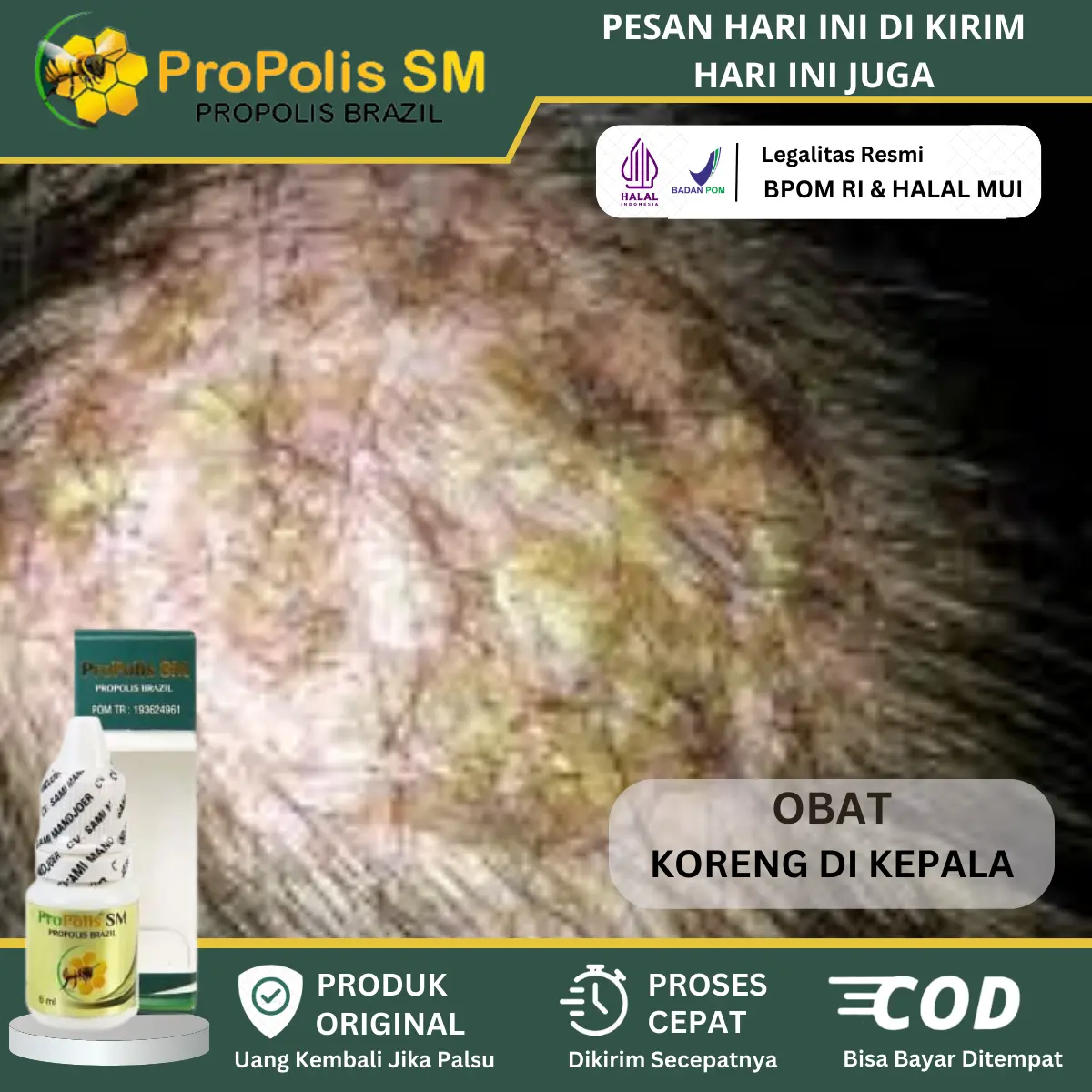 Salep Oles Koreng Herbal, Koreng di kepala, Luka Koreng di Kulit Kepala, Oles Koreng di Kepala, Salep untuk Koreng di Kepala Anak dan Dewasa, Penghilang Bekas Koreng di Kepala, Psoriasis Kepala, Ketombe Berkerak, Jamur di Kepala Propolis SM