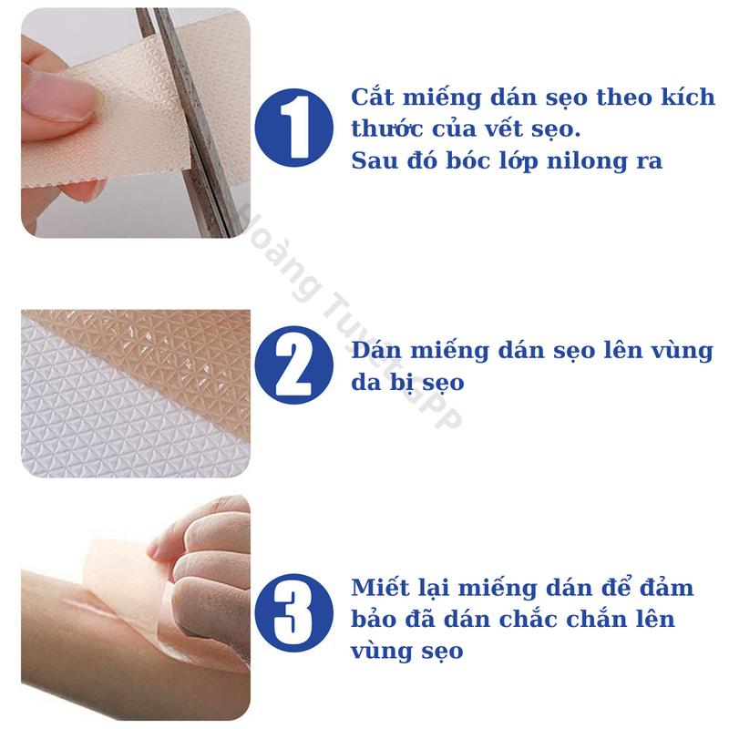 Product Introduction of Miếng dán sẹo silicone phẳng sẹo lồi, sẹo sau sinh, sẹo nâng ngực, sẹo bỏng ScarPass sạch sẹo, sáng da, ngừa thâm 42