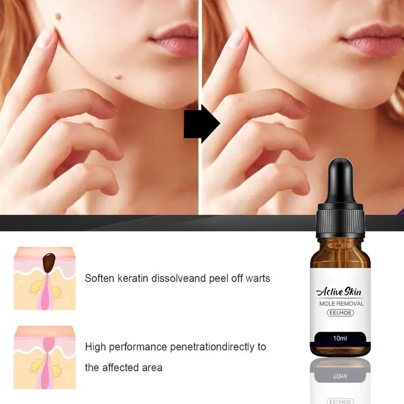 Eelhoe Aclive Skin Mole Removal, Serum Penghilang Tahi Lalat Dan Kutil Isi 10ml Perawatan Essence Cairan 3