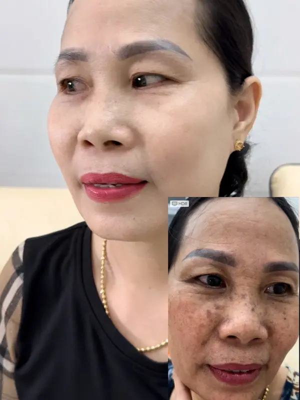 COMBO KEM FACE NGÀY và ĐÊM Sâm nám 8G ban đêm.Bạch nhân sâm 8G ban ngày TẶNG KÈM SERUM 6