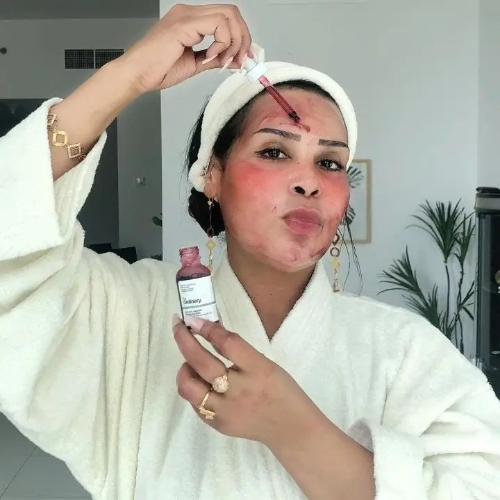 ~ SHARE IN JAR ~ ORDINARY PEELING SOLUTION ORGINAL CANADA Wajah 0