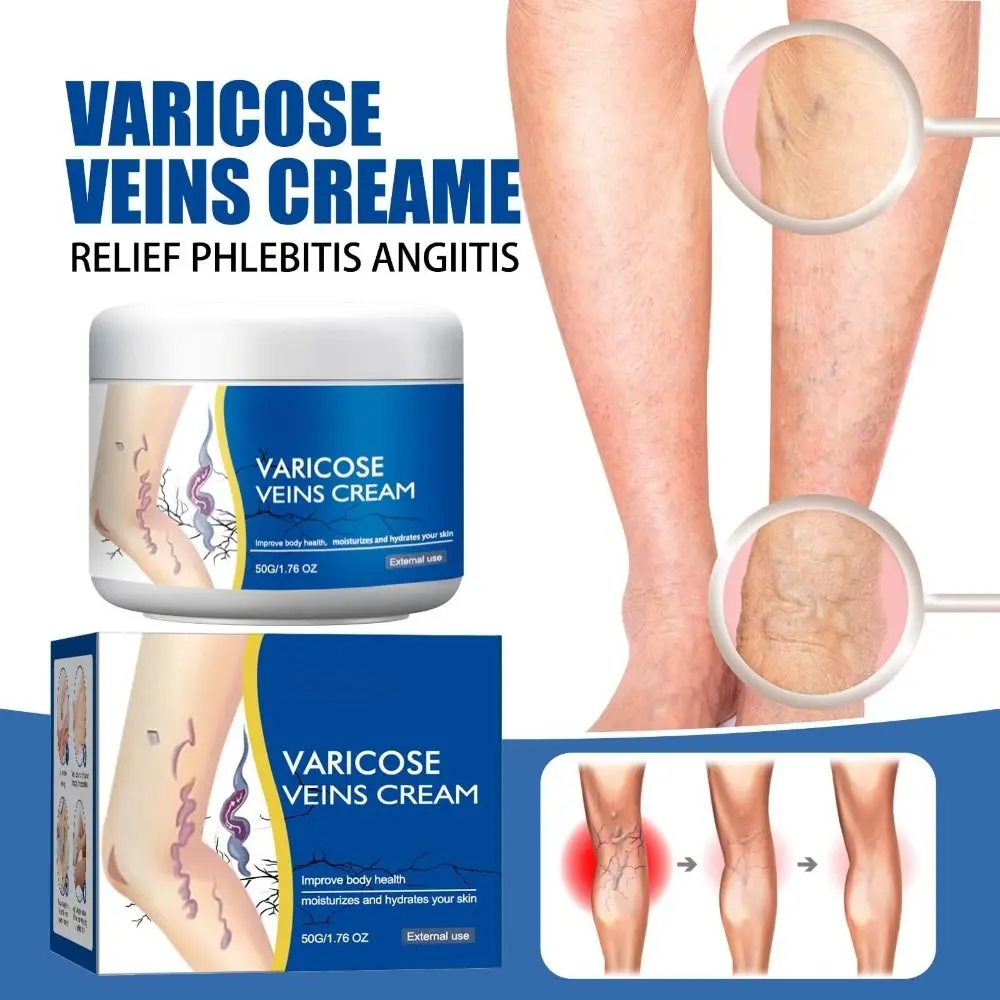 New 50g/1.76fl.oz Legs Varicose Veins Treatment Mild & Safe Pain Relief Legs Skin Cream Moisturizes The Skin Varicose Veins Relief Cream for Men And Women