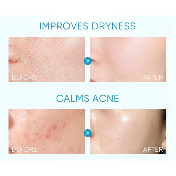Product Introduction of SKINTIFIC 5X Ceramide Barrier Moisture Cream Ceramide Moisturizer Repair Skin Barrier Moisturiser 80g Valentine Gift Skincare Daily Restore Comfort Hydrating Hydrate 10