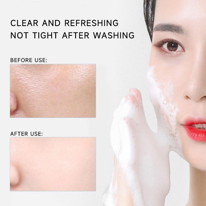 【100%  Asli】ANUA Heartleaf Quercetinol Pore Deep Cleansing Foam 150ml/ANUA Cleansing Oil 200ml /ANUA 77% Toner 250ml / Anua Peach 70% Niacinamide Serum 30ml 5