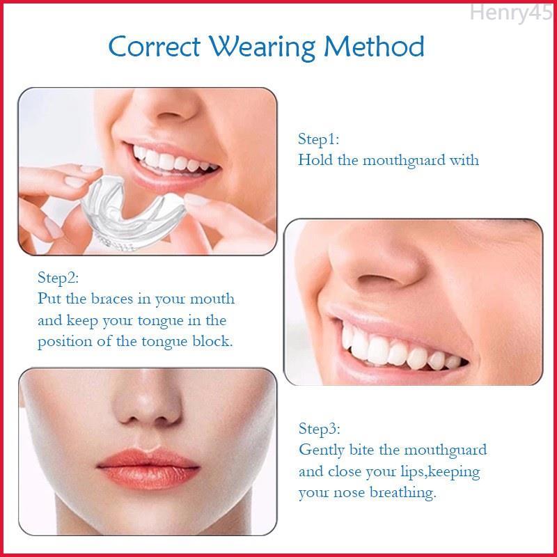 Product Introduction of Henry45 ฟันยาง ยางกันฟันนักมวย Mouth Guard ฟันยางซิลิโคน ยางครอบฟัน ยางกัดฟัน พร้อมกล่อง ใช้ได้เด็ก/ผู้ใหญ่/นักกีฬา/นักมวย 5