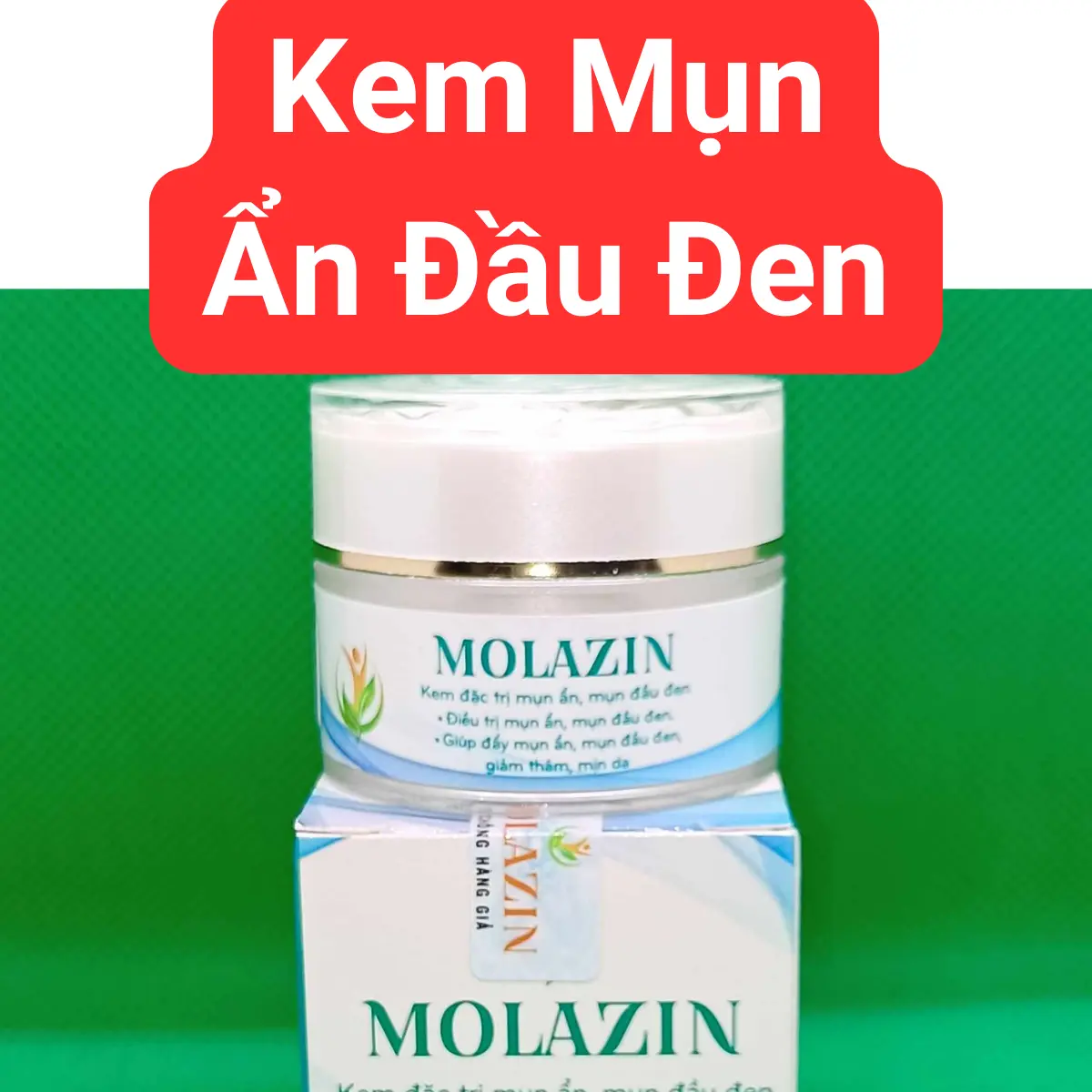 Kem chấm mụn ẩn, mụn đầu đen Molazin dành cho da mặt Cho Da Mụn Làm Đẹp Da