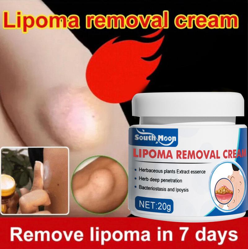 Krim Perbaikan Benjolan Lemak, Benjolan Keras, Benjolan Subkutan, Lipoma, Salep Benjolan, Krim Penghapus Lipoma, Secara Khusus Menghilangkan Beberapa Benjolan Subkutan Tunggal, Krim Benjolan Kulit / Obat Benjolan Efektif
