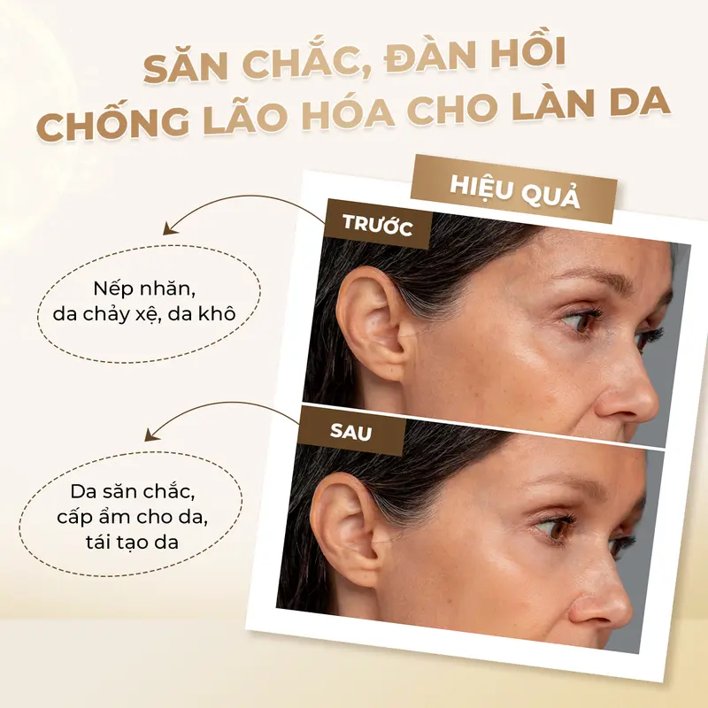 Mặt Nạ Vàng hỗ trợ săn chắc da, nâng cơ và dưỡng ẩm dịu nhẹ Laonmedi Meso Lifting Care 30ml (10 miếng) Skincare Cosmetics  VKM Hàn Quốc 4