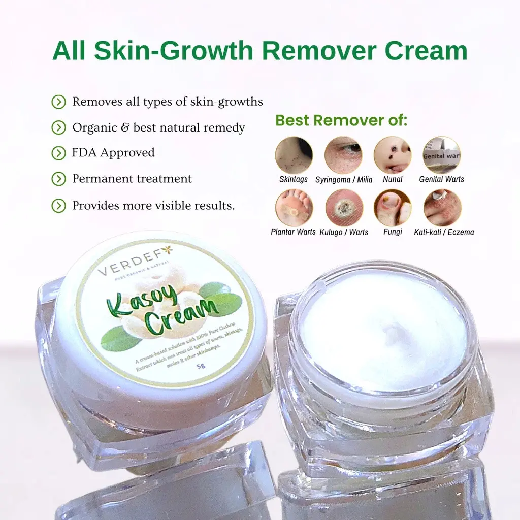 New Strong Kasoy Cream Organic Safe & Effective Remover of Warts Mole Skintags Syringoma by VERDEFY