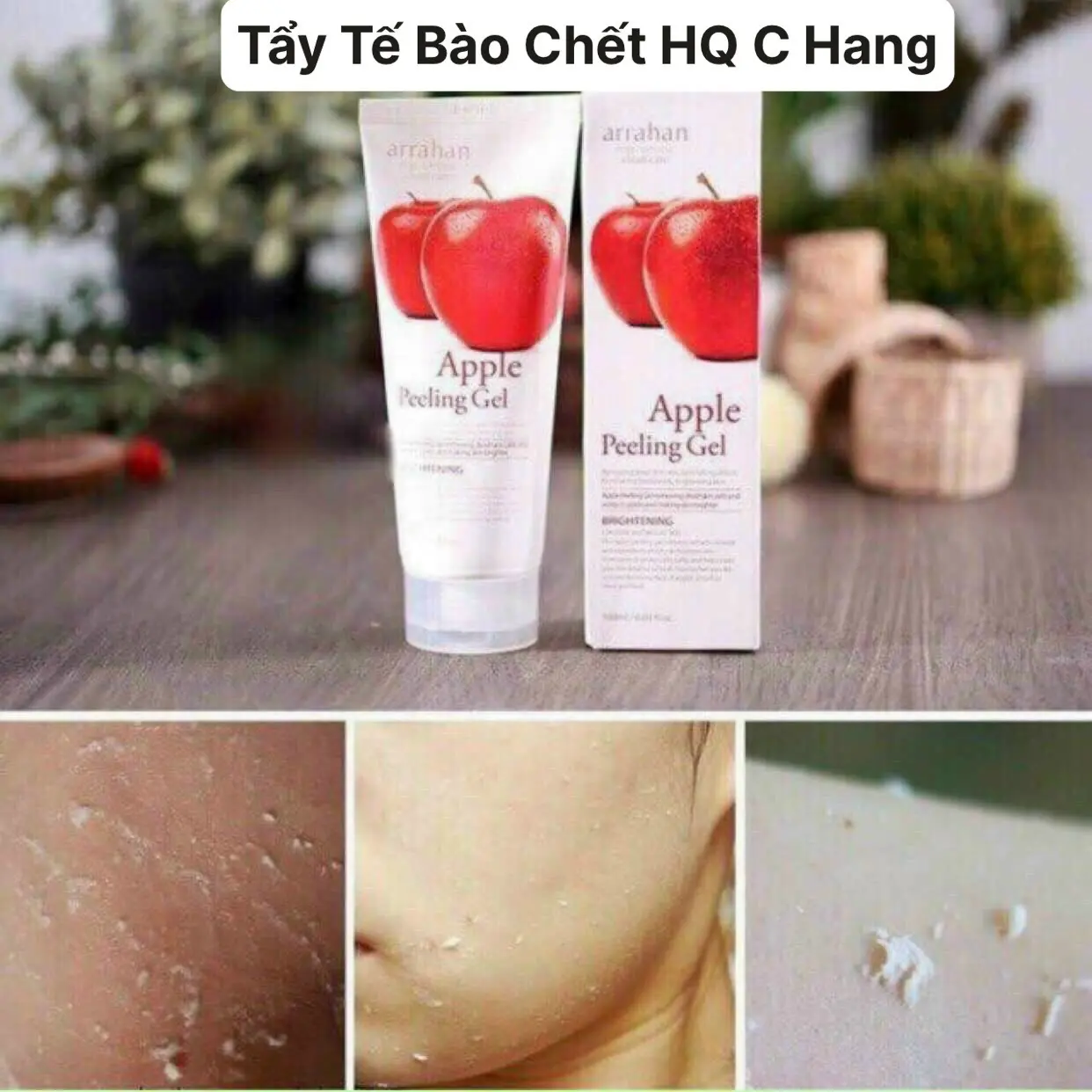 GEL TẨY TẾ BÀO CHẾT LÀM SẠCH DA, Apple Peeling Gel 180ml HQ