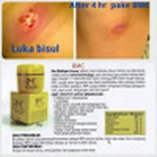 Krim Untuk Luka Bakar BMC (Bio Cream 30 gr) KK Indonesia Menggunakan Nano Techonolgy, Berbahan dasar Herbal, Membantu meringankan iritasi kulit, Melembabkan dan Mendinginkan Kulit, Menyembuhkan Hidung tersumbat/Flu, Keseleo, Ketombe dll 2