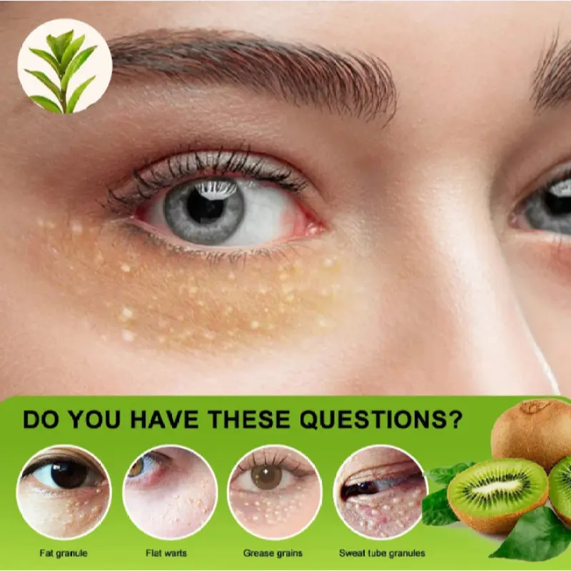 Krim Herbal Penghilang Milia dan Bintik Lemak Area Mata & Hidung dengan Vitamin E - Perawatan Wajah 20g | Formula Alami Efektif 3