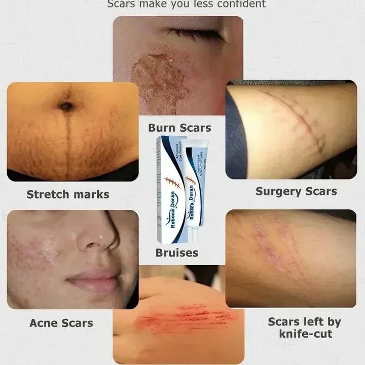 Product Introduction of Maternity Cream That Enhances Elasticity, Gentle Skin Care After Pregnancy, Eliminates Stretch Marks, and Is Very Effective body  moisturizers 13