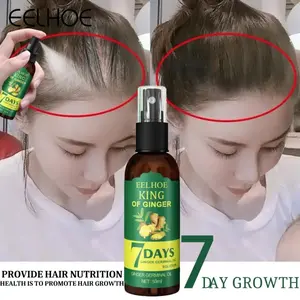 Eelhoe Obat Penumbuh Rambut Anti Rontok / Obat Rambut Botak Ginger Germinal Oil 7 Days Aman Terbukti [X28]