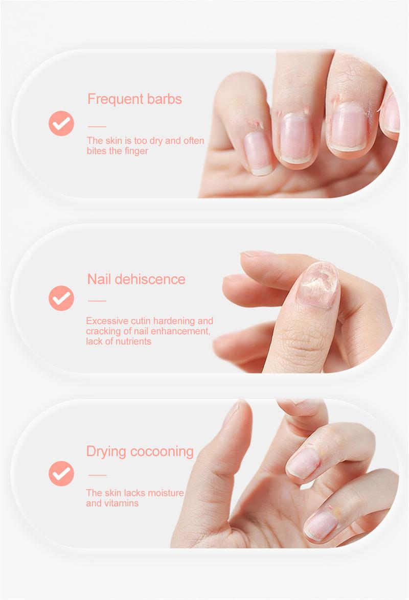 Product Introduction of 【Buy 1 Get 3 Free】AS 4pc Ungluing Agent Nail Special Remover Nail Water Wear Nail Glue Dissolving Liquid Nail Drilling Jewelry Powerful Removal Tool 37